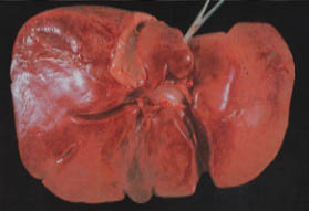 A Healthy Human Liver